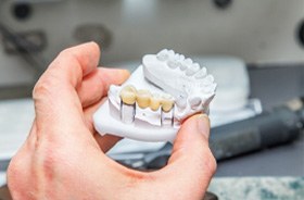 Dental bridge in Corbin on clay model