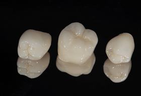 dental crowns in Corbin sitting side-by-side