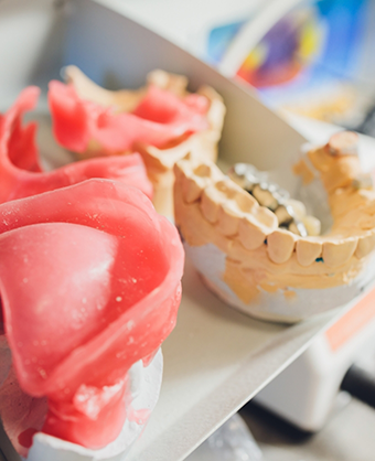 Models of dentures and impressions of teeth in a dental lab