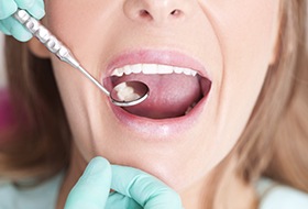 Closeup smile during dental exam