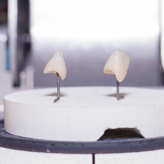 Close up of two dental crowns