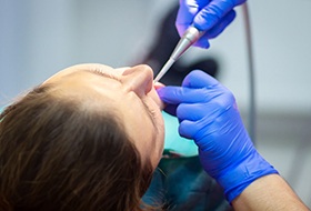 A patient undergoing dental work after receiving sedation in london kentucky
