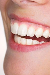 Closeup of healthy teeth and gums