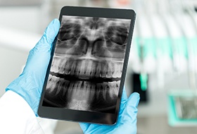 Dental x-rays on tablet computer