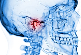 Damaged jaw joint