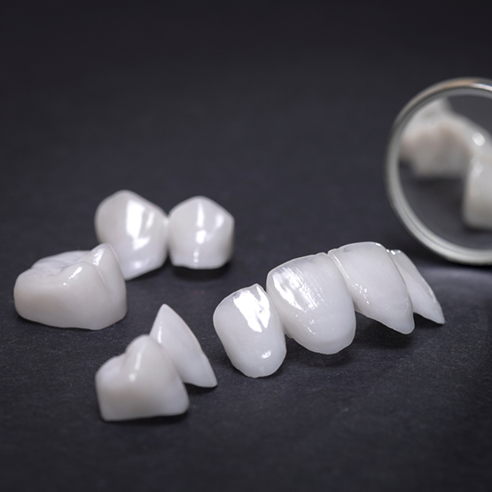 Several veneers next to a dental mirror