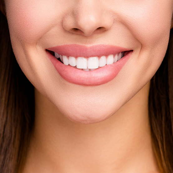 Woman smiling with flawless teeth
