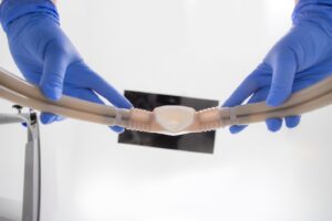 Point-of-view picture of gloved hands lowering a nitrous oxide nasal mask onto patient.
